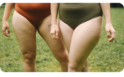 Lipedema - ¿qué es? - ¿Cómo puede ayudar la fisioterapia?