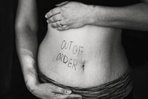diastasis-informacion