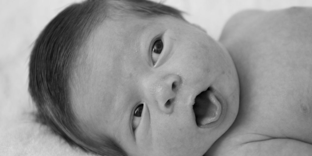 frenectomia-frenillo-bebe-fisioterapia-vicetto